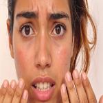 Beauty Care : तेज धूप में बढ़ा सनबर्न का खतरा, एलोवेरा, खीरा और गुलाब जल से पाएं राहत