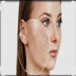 गर्मियों में शरीर को हाइड्रेट रखने के आसान और कारगर उपाय