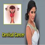 Health Advice : भारत में बढ़ रहा सर्वाइकल कैंसर का खतरा, इन लक्षणों को अनदेखा न करें: डॉ. मीरा पाठक