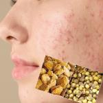 Skin Care Tips: गुड़ और चने से ठीक हो जाएंगे चेहरे के दाग धब्बे, जानिए तरीका
