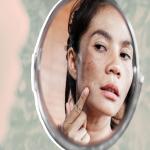 चेहरे के दाग धब्बे हो जाएंगे दूर, किचन की इन चीजों का करें इस्तेमाल