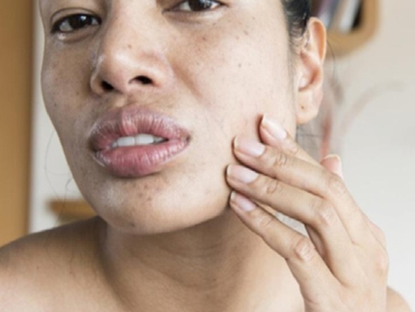 Beauty Care :  समय से पहले मुरझा रही है त्वचा, अधूरी नींद है झुर्रियों का असली कारण
