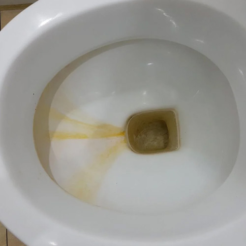 Cleaning Tips: टॉयलेट सीट पर लगे हैं जिद्दी पीले दाग, तो इन आसान तरीकों से करें क्लीन