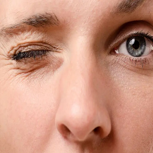 आंखों के फड़फड़ाने को ना करें नजरअंदाज, इन चीजों का होता है संकेत