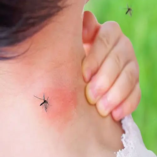 बच्चों को मच्छरों के आतंक से बचाने के लिए करें ये काम, नहीं होगी कोई बीमारी