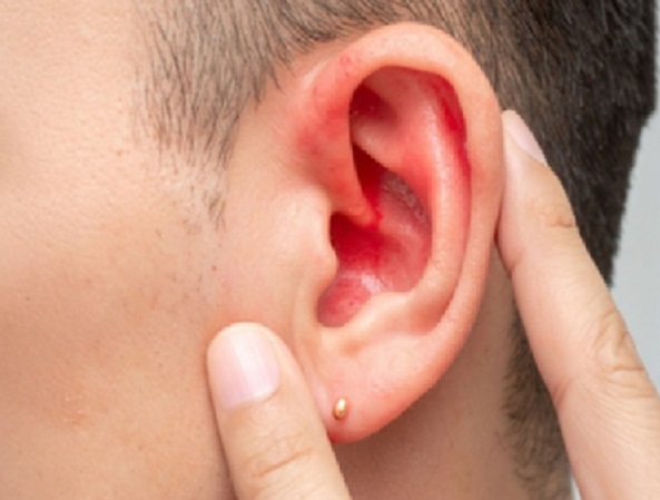 अदरक और सेंधा नमक से बना तेल कानों के दर्द से आराम दिलाने में है प्रभावी, जान लें प्रयोग से पहले की सावधानी