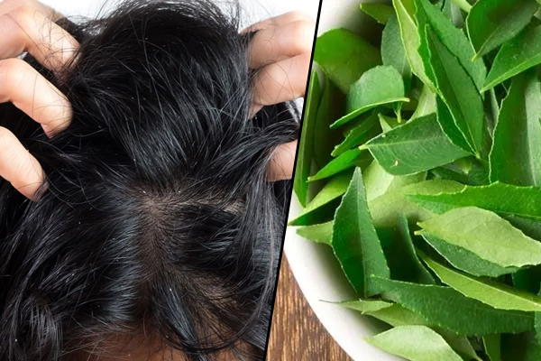 Hair Care: डैंड्रफ को जड़ से खत्म करेंगे कढ़ी के पत्ते, जानिए क्या है तरीका