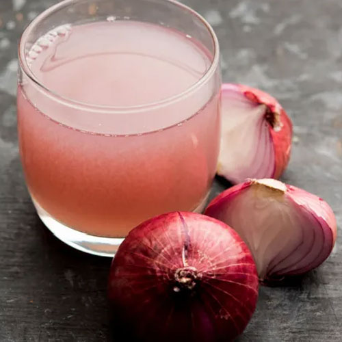 Hair Care Tips: बालों को मजबूत बनाएगा प्याज का रस, बिल्कुल नहीं होगा हेयर फॉल 