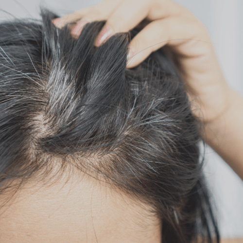 Hair Care Tips: इन गलतियों की वजह से वक्त से पहले सफेद हो जाते हैं बाल, ये घरेलू तरीके करेंगे काला