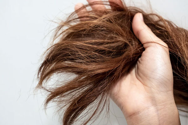 सर्दियों में बाल हो जाते हैं डैमेज, इस तरह रखें हेल्दी