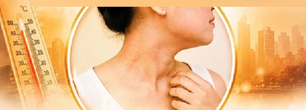 Health Tips: भीषण गर्मी में त्वचा की समस्याएं : होम्योपैथी से पाएं प्राकृतिक और सुरक्षित समाधान
