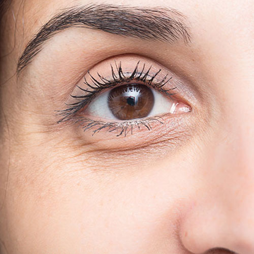 Health Tips: आंखों के नीचे की सूजन खूबसूरती करती है खराब, ऐसे करें आई केयर