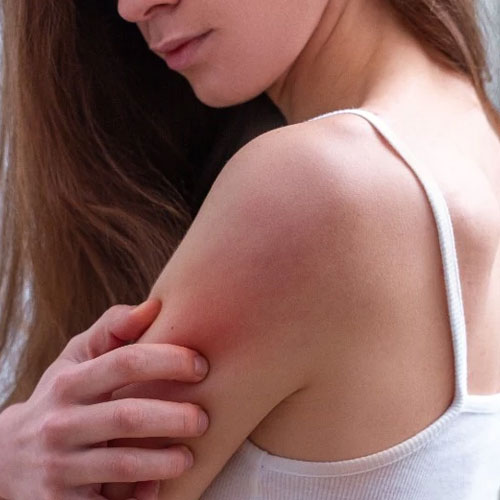 सर्दियों में हाथ पैर पर आ रहे हैं रेशेज, तो इस तरह बनाएं सॉफ्ट