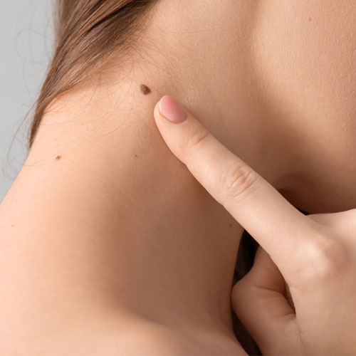 शरीर के इन अंगों पर है तिल तो जानिए क्या है मतलब