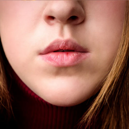 अपर लिप्स पर दिख रही है डार्कनेस, तो इन तरीकों से दिखें ब्राइट