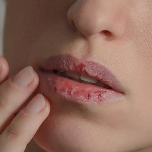 Lips Care Tips: होठों पर जम गई है डेड स्किन सेल्स की पपड़ी, तो इस तरह करें रिमूव 