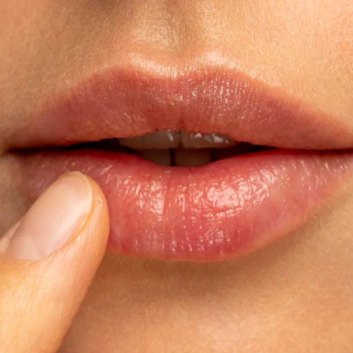 Lips Care Tips: सर्दियों में होठों पर जमने लगी है पपड़ी, तो इस तरह करें लिप केयर