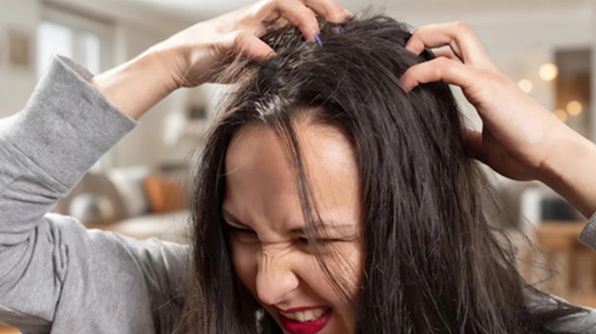 Moms & Baby Care : सिर से जूं को तुरंत खत्म करेंगे ये दो उपाय, खुजली और डैंड्रफ से भी मिलेगी राहत
