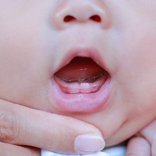 Parenting Tips: बच्चे दांत निकलने पर हो जाते हैं चिड़चिड़े, इन तरीकों से दर्द को करें कम