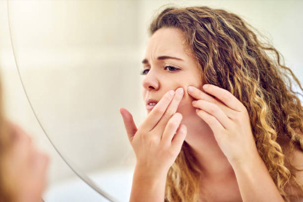 Skin Care: बार-बार हो रहे हैं कील मुहासे, तो अपनाएं ये स्किन केयर रूटीन
