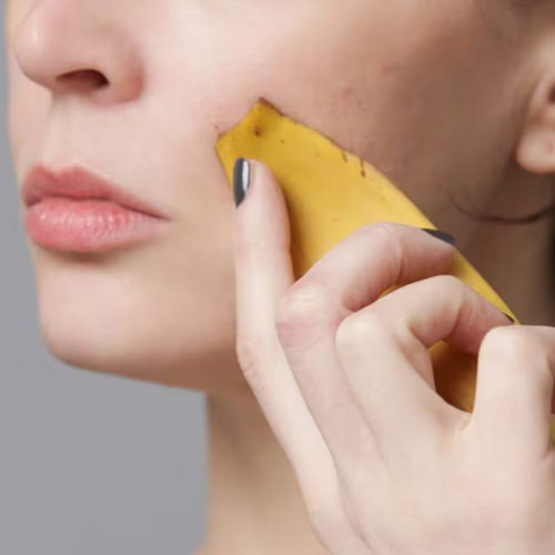 Skin Care Tips: ग्लोइंग स्किन के लिए बेस्ट है केले का छिलका, इस तरह करें इस्तेमाल