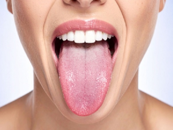 त्रिदोष के असंतुलन का संकेत देती है जीभ, रंग से पहचाने शरीर के विकार