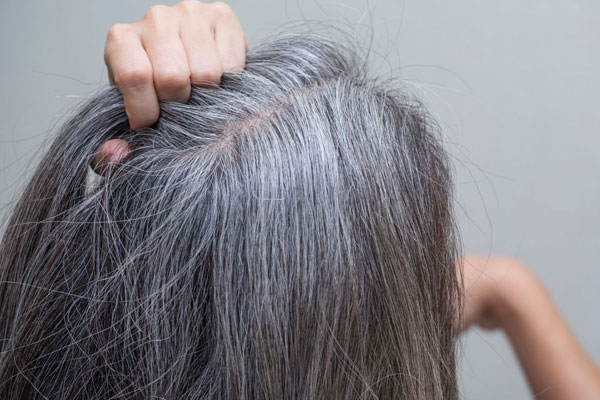 उम्र नहीं, पोषण की कमी की चेतावनी देते हैं सफेद बाल, कैसे पाएं इससे छुटकारा