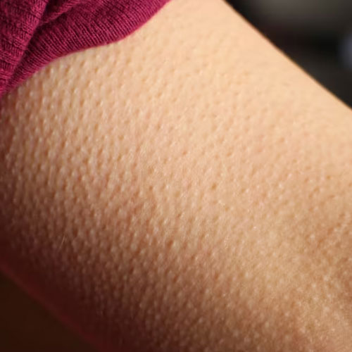 भावनाओं में क्यों खड़े हो जाते हैं रोंगटे, हैरान कर देगी वजह